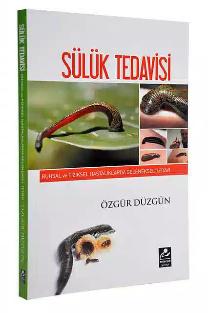 Sülük Tedavisi Kitabı (Özgür Düzgün)-1576